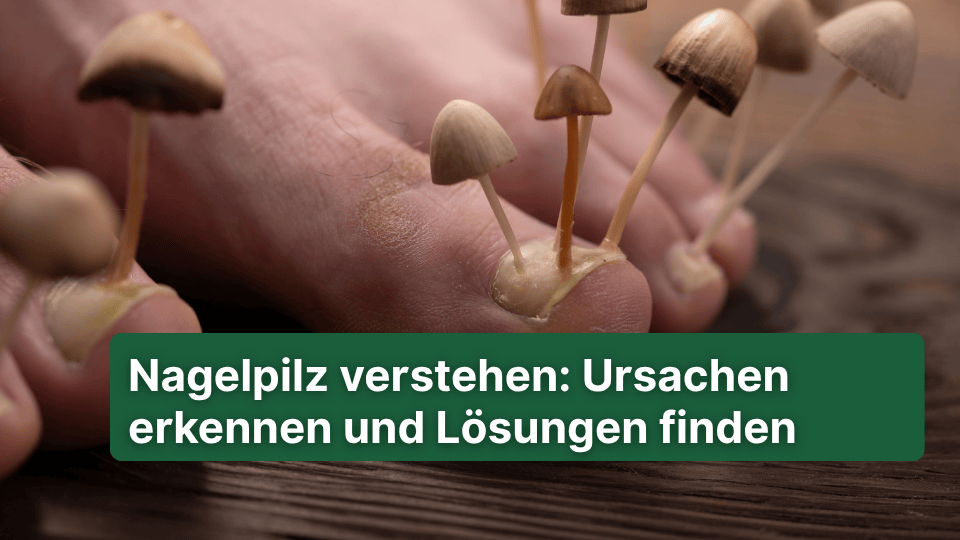 Nagelpilz verstehen: Ursachen erkennen und Lösungen finden - Doktor Health
