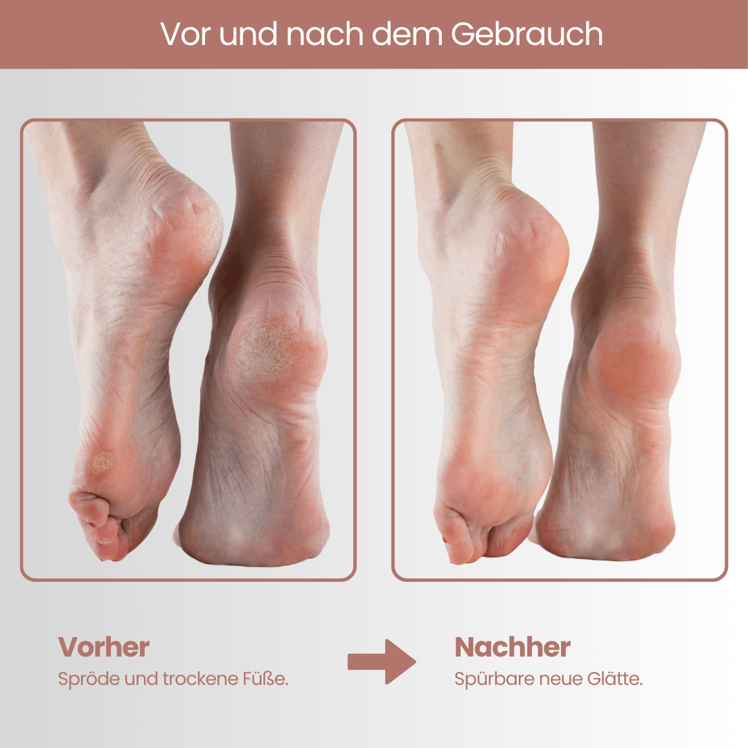 Fußmaske - Doktor Health